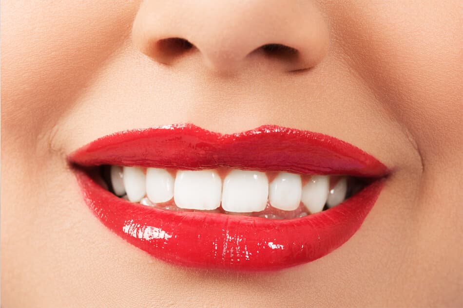 Estética dental en la Clínica Dental Senlleira