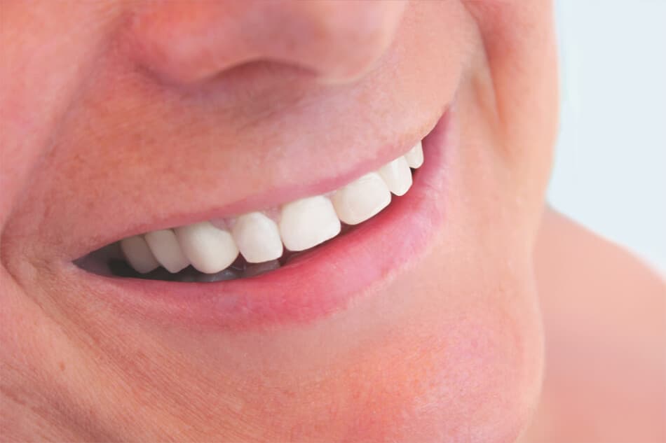 Implantología dental en la Clínica Dental Senlleira